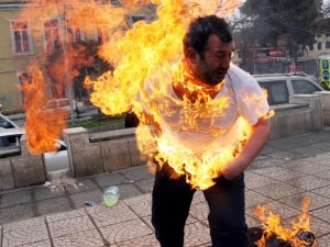 O ’dehşet fotoğraf’taki kişi konuştu: "Ateşe yaklaşamıyorum"