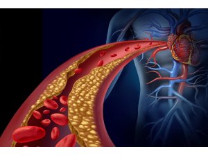 Yüksek kolesterollü hastalara yeni umut: Kolesterol aşısı