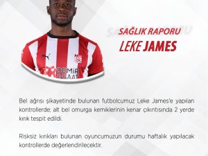 Sivasspor’a Leke James’ten kötü haber!