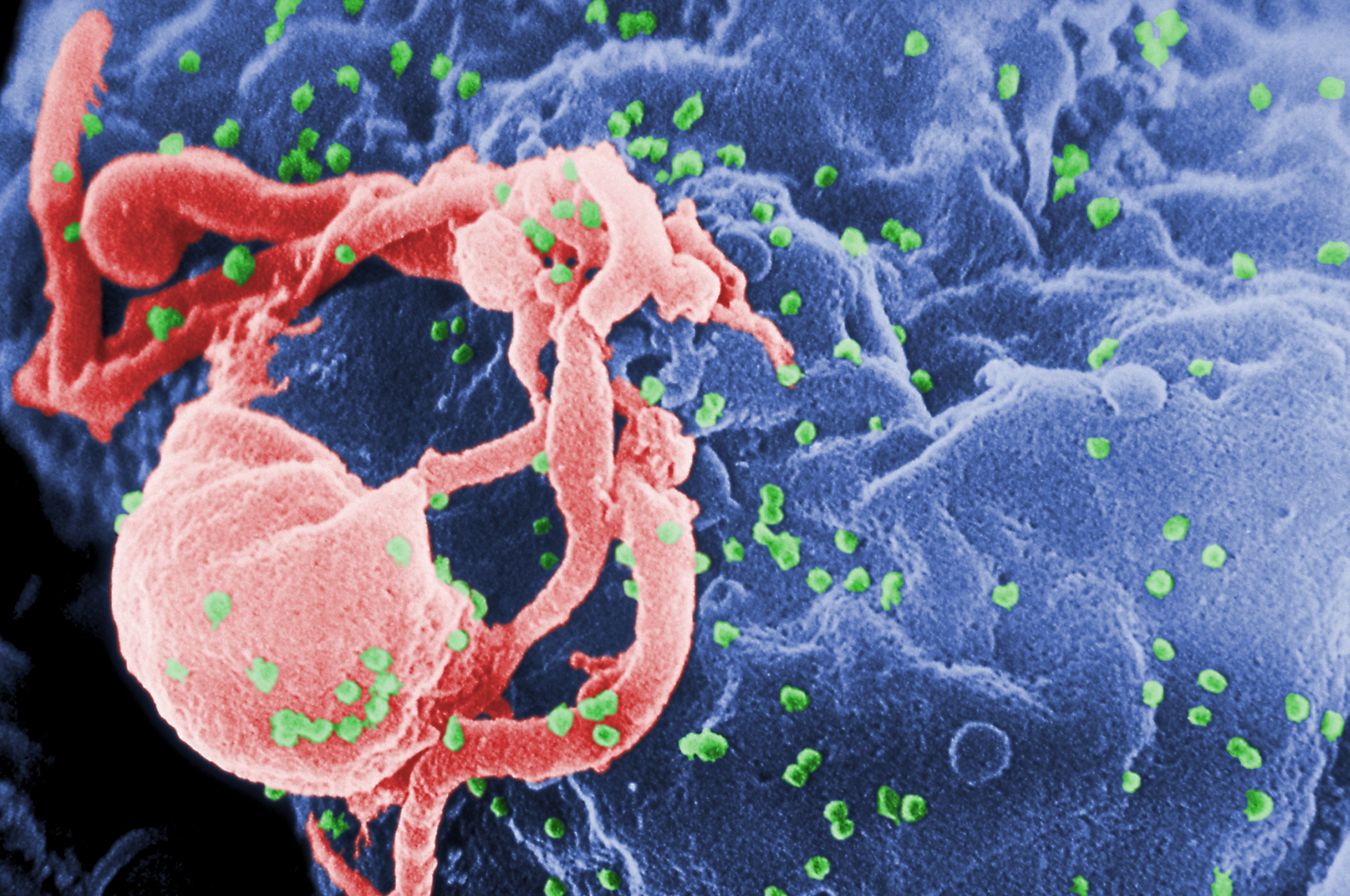 HIV nedir, neden olur? Tedavisi var mı?