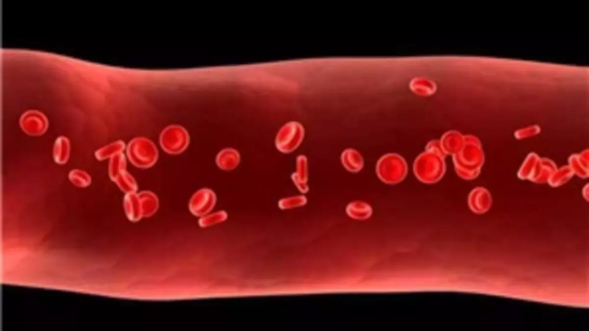 Kan pıhtılaşmasına ne iyi gelir? Doğal yöntemlerle kan pıhtılarından korunun