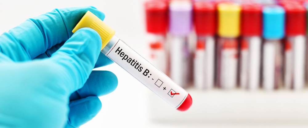 Hepatit B, karaciğer sirozuna yola açabilir