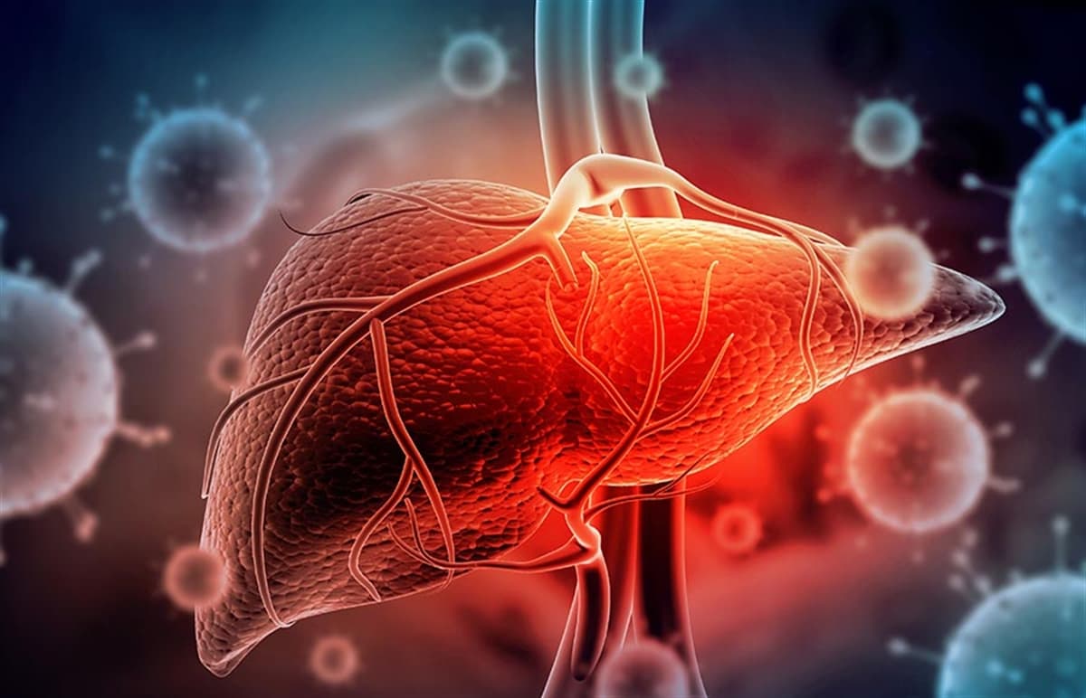 Hepatit, siroz ve diyabet, karaciğer kanseri riskini artırıyor