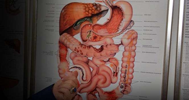 Hemoroid (Basur) nedir? Nasıl Çıkar ?Hemoroid nasıl geçer? Basur tedavi yöntemleri neler?