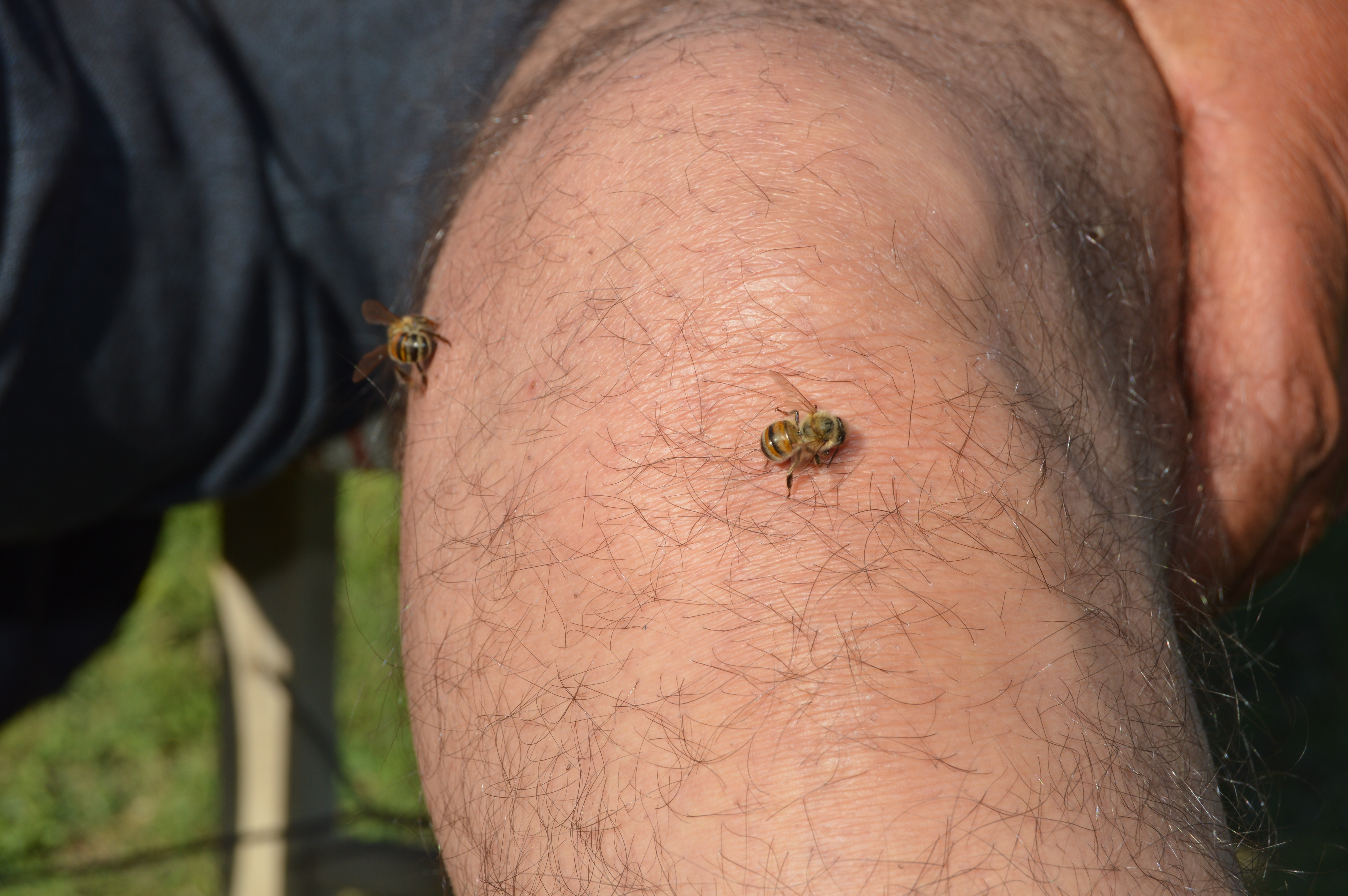 Ağrı’da arı iğnesiyle doğal akupunktur tedavisi