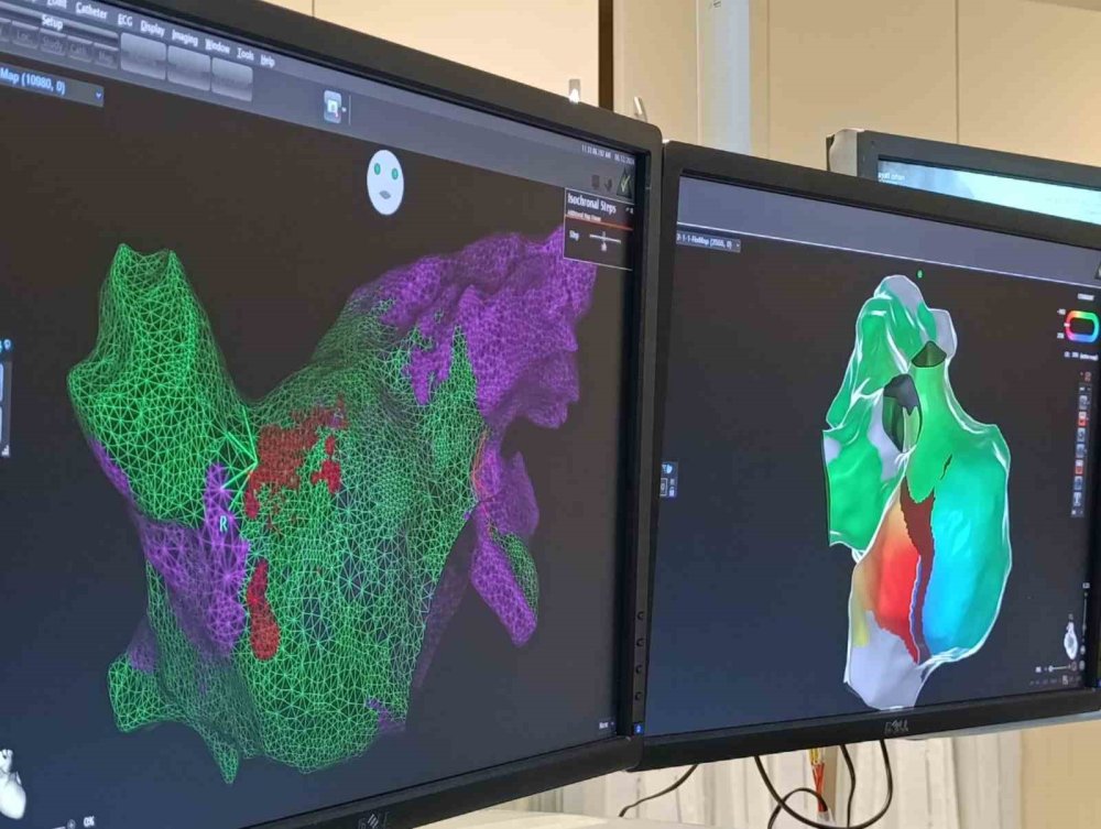 Van’da kalp çarpıntısına yeni tedavi